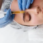 Dripology – Home IV TherapyBotox at Dripology