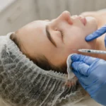 Dripology – Botox (1) at Dripology