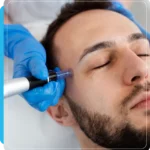 Microneedling treatment at Dripology medspa - photo 1