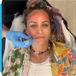 PRP Facial at Dripology