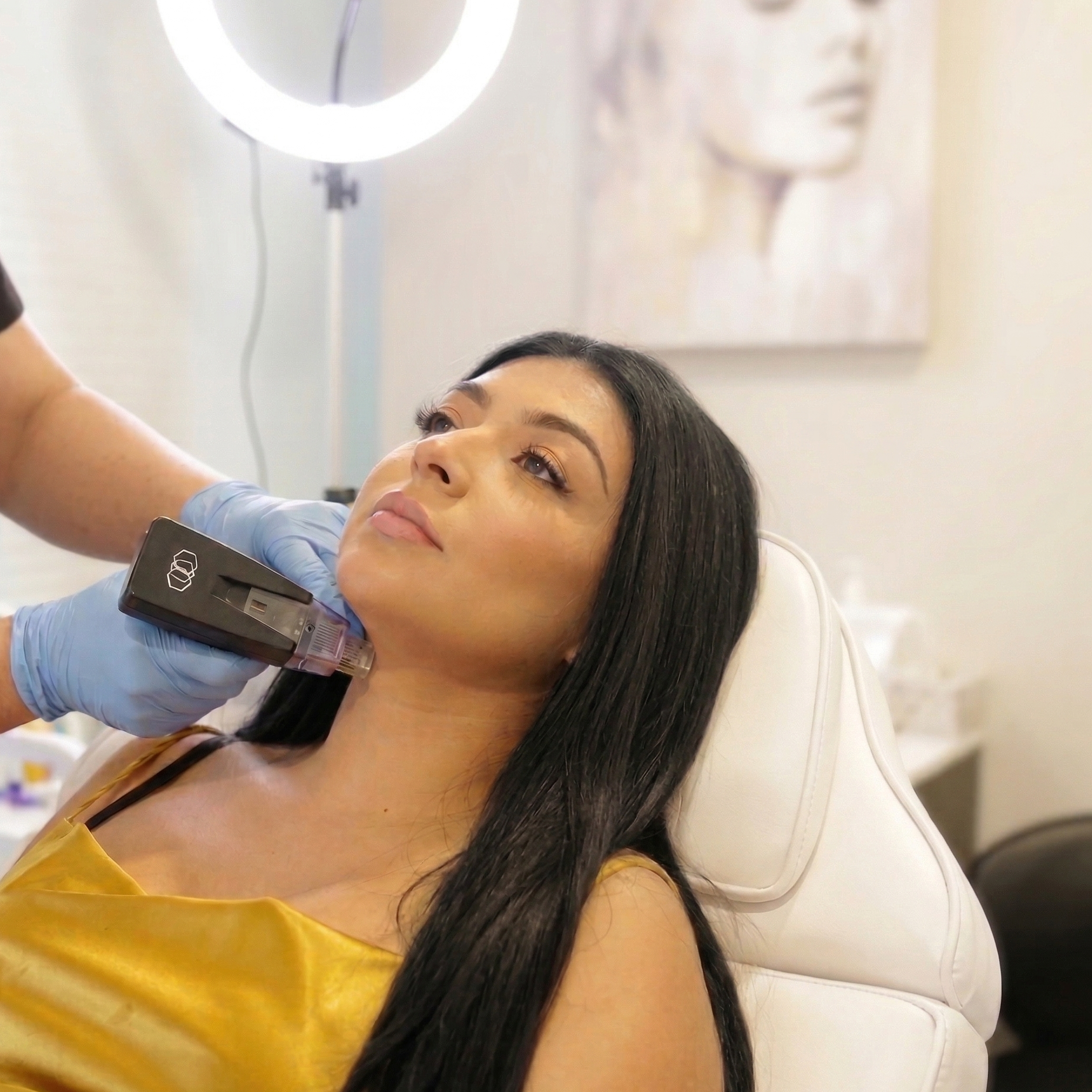 Morpheus8 Face Treatment at Dripology