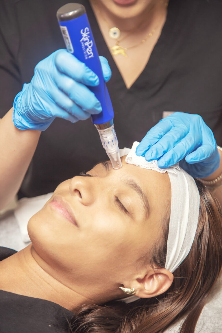 RF Microneedling in Santa Monica at Dripology