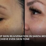 PRP facial treatment at Dripology medspa - photo 3